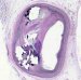Using Nanotechnology to Treat Diseases of the Heart and Lungs