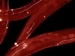 Neuron Regeneration Using New Microchip Technology