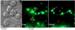 Scientists Discover Molecular Level Cellular Interactions of Nanoparticles