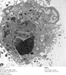 Gadonanotubes Are More Effective in Tracking Stems Cells in Body