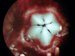 Research Team Finds How Nanocrystals Make Sea Urchin’s Tooth Sharp