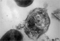 Biodegradable Polymer Nanoparticles Combat Drug-Resistant Superbugs