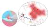 Glowing Nanoparticles Called Cornell Dots Detect Cancer Cells in Humans