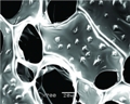 Researchers Use Gold Nanowires to Create Cardiac Patches