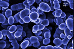 Carbon Nanoparticles Make Detection of Parkinson's Disease Easier