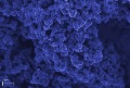 Carbon Nanoparticles Can Help Detect Parkinson’s Disease