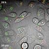 Novel Imaging Tool Aids Efficient Use of Nanoparticles in Drug Delivery