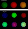 Polymersome Study Helps Advance Nanomedicine Applications