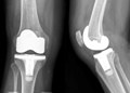 Early Nanotoxicology Study Results Support Use of Nanodiamonds in Implants