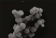 New Nanosized Microspheres Containing RNA May Help Treat Cancer