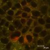 Study Reveals Nanoparticles May Affect Human Health Even in Small Doses