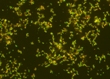 New Nanoparticles Can Deliver Large Doses of Antibiotics to Bacteria