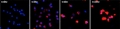 Nanoparticles Offer Potential for Treating Blood Cancer