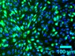 Custom-Designed Molecular Beacons Help Monitor Stem Cell Transformation in Real-Time