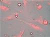 Nanoparticles Selectively Release Drugs in Aged Human Cells