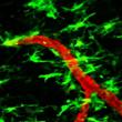 New Two-Photon Laser Scanning Microscopy Study Helps Understand MS Nerve Damage