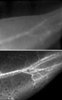 Researchers Develop New Blood Flow Visualization Technique Using Carbon Nanotubes and Lasers