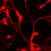 Engineered Nanomaterial Can Help Regulate Chloride Levels in Nerve Cells