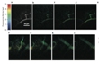 New Microscopy Technique for Biological and Medical Imaging Research