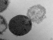 Transmission Electron Microscopy Employed to Study Hole Formation in Biophysical Model of Bacterium