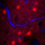 Improved Biological Imaging Using Three-Photon Microscopy