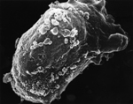 Researchers Work on Developing New HIV Vaccines