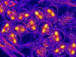 Interdisciplinary Collaboration in Microscopy Explored at Innovations in Imaging Meeting