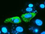 Lipid Nanoparticles Act as Ideal Vectors in Gene Therapy