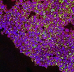 Nanotechnology Facilitates More Targeted Treatments