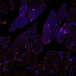 Researchers Develop Self-Assembled Targeted Nanoparticles Capable of Resolving Inflammation