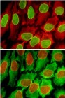 Scientists Employ Quantum Dots for Single-Cell Analysis and Clinical Diagnosis