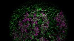Innovative Microfluidic Chip Enables Rapid and Accurate Cancer Profiling