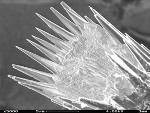 Transmission Electron Microscopy Helps Resolve Crystal Structure of Mineral Vaterite