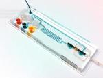 Portable Device Combining Microfluidic Technology and NMR Helps Diagnose Tuberculosis