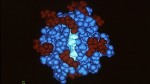 New Infrared-UV Laser Method to Accurately Determine Structure of Proteins