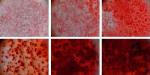 Synthetic Silicate Nanoplatelets Induce Stem Cells to Become Bone Cells