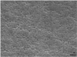 Magic Bullet' Nanomedicine may Effectively Treat Acute Lung Injury