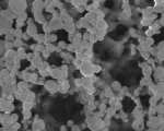 Injectable Nanoparticles may Simplify Treatment for Type 1 Diabetes
