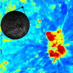 Confocal Microscopy and Fluorescence Lifetime Imaging Combined can Help Detect Cancer Noninvasively