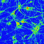 Fluorescent Probes Developed for Molecular Imaging of Copper in the Brain