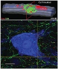 Single Injection of Human Neural Stem Cells Improves Function Impaired by Acute Spinal Cord Injury