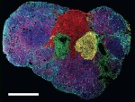 Novel Mass Spectrometry Imaging Technique Captures Kinetic World of Metabolites