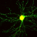 Engineered Microscopic Probes Light Up Synapses in Living Neuron in Real Time