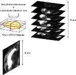 Sugar Solution Combined With Fluorescence Microscopy Delivers Detailed Mouse Brain Images