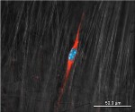 Bioengineering Graduate Student to Design Nanofiber Scaffold as Synthetic Tendon Replacement