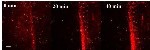 Self-Powered Nanoparticles Target Newly Formed Microcracks in Bones