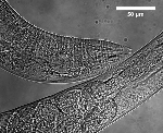 Researchers Manipulate C. elegans Nematode to Investigate Biomechanics and Neuroscience of Touch