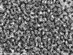 Titanium Dioxide Nanotubes May Help Improve Longevity of Dental Implants