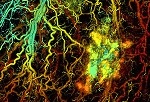 NIH Awards $3.5 M for Advancing Single-Cell Label-Free Photoacoustic Microscopy for Cancer Detection