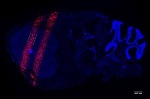 Researchers Develop Microbeam Emitter Using Carbon Nanotube-Based X-Ray Source Array Technology